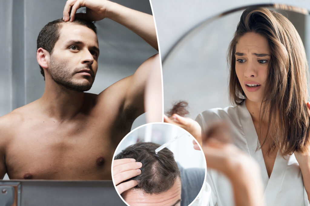 Which hair loss remedies act really and the side effects to look, from dandruff to sexual dysfunction